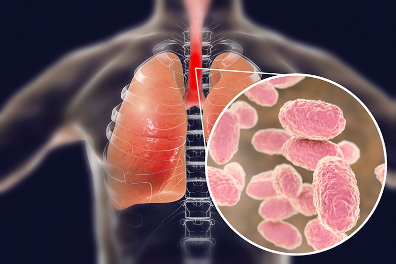 dinkes-kota-tangerang-imbau-orang-tua-waspadai-pertussis-pada-anak